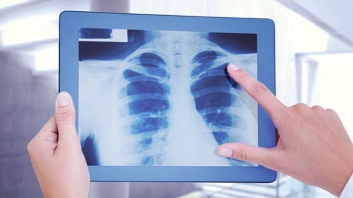 Cuidados na hora de realizar o exame