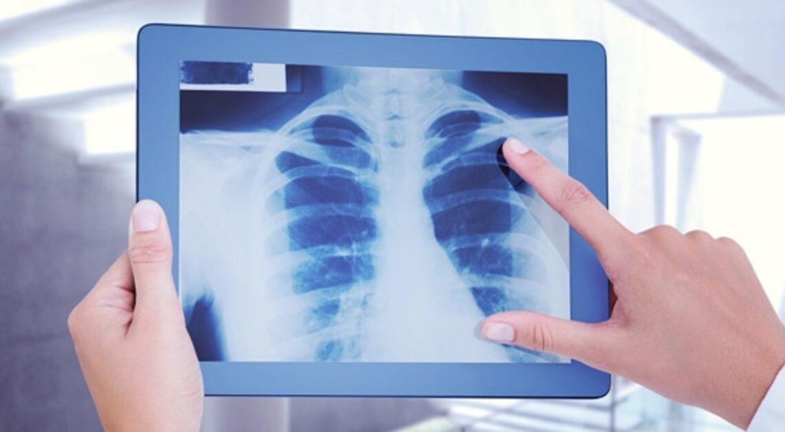 Cuidados na hora de realizar o exame