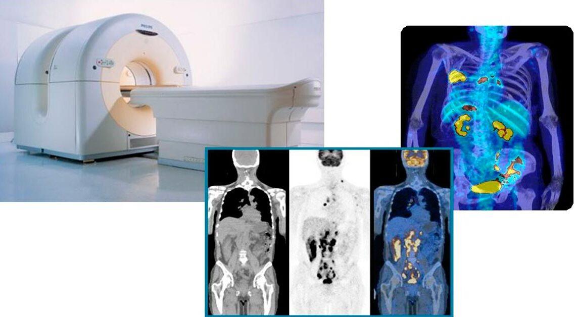 O que é a tomografia por emissão de pósitrons ou PET Scanning