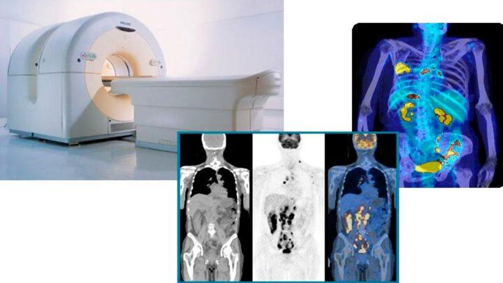 O que é a tomografia por emissão de pósitrons ou PET Scanning