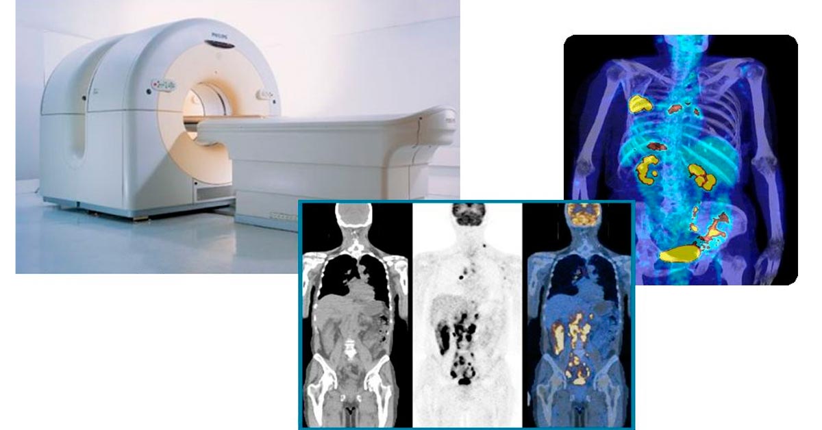 O que é a tomografia por emissão de pósitrons ou PET