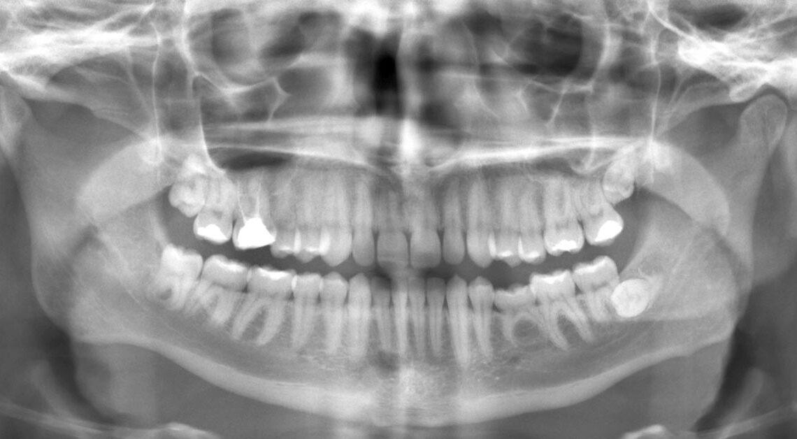 O que é radiologia odontológica?