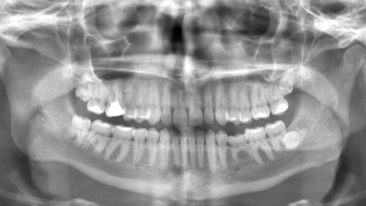 O que é radiologia odontológica?