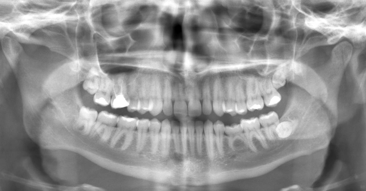 O que é radiologia odontológica?