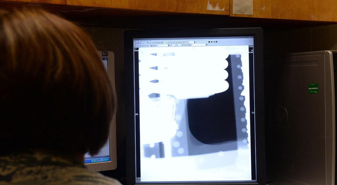 Equipamentos de Radiografia Computadorizada