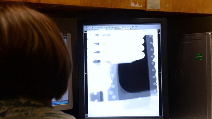 Equipamentos de Radiografia Computadorizada