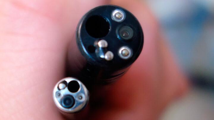 Os mais recentes avanços em radiologia