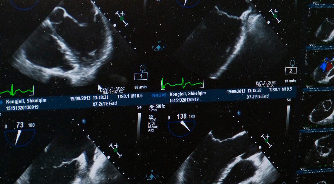 Tipos de imagens de ultrassom