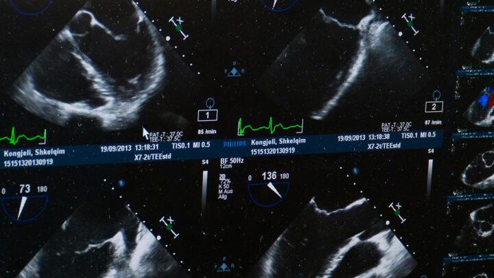 Tipos de imagens de ultrassom