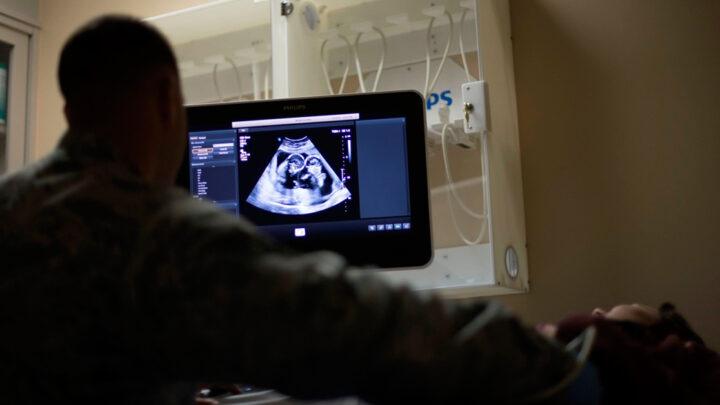 Ultra-som: A avaliação do risco e benefício potencial