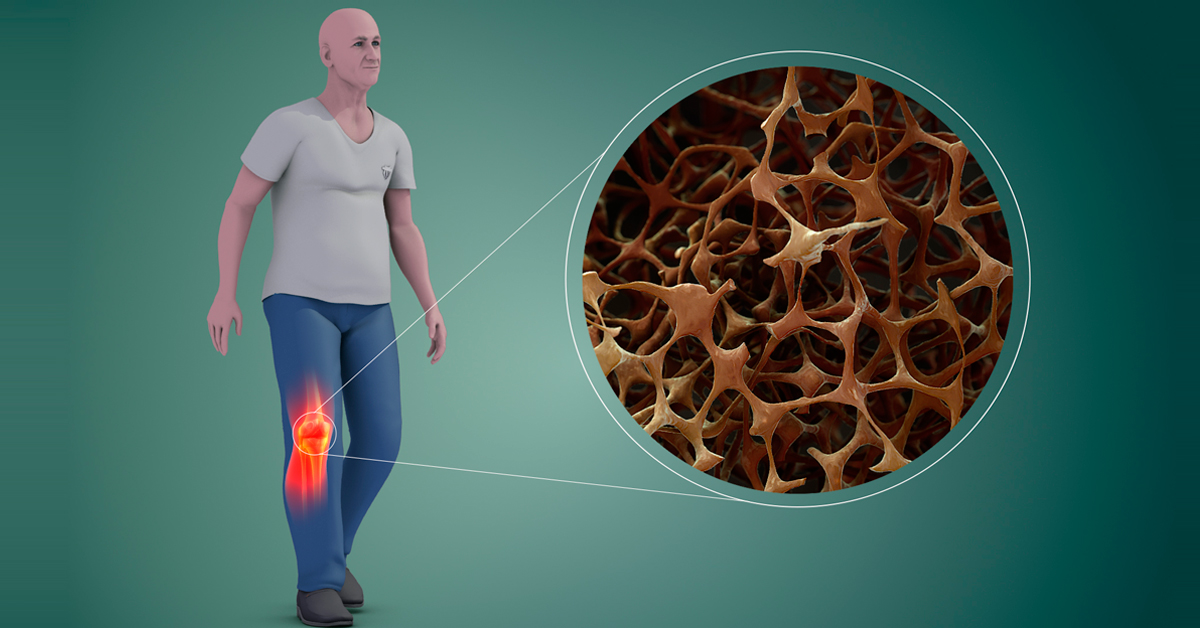 Densitometria Óssea e Osteoporose