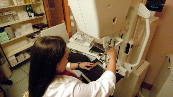 Diretrizes para mamografia