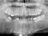 radiologia dentaria um programa de assistencia odontologica