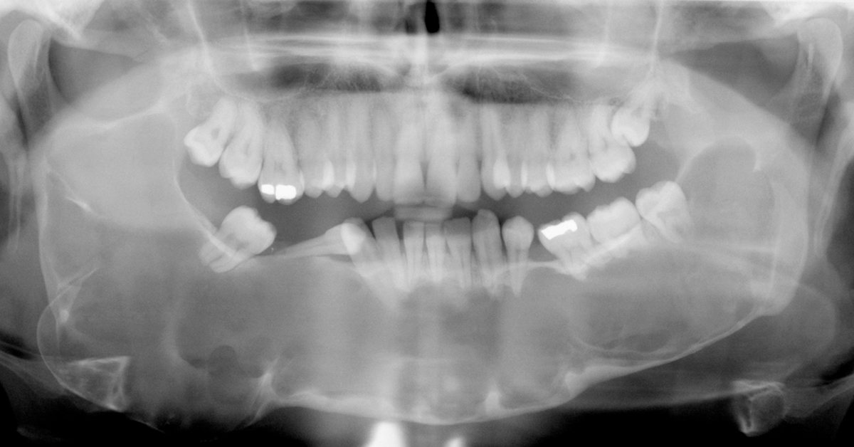 A importância de obter um raio X dental