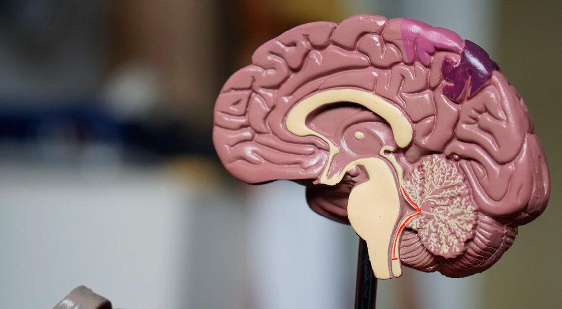 Ressonância Magnética de um Cérebro Humano