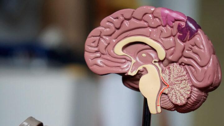 Ressonância Magnética de um Cérebro Humano